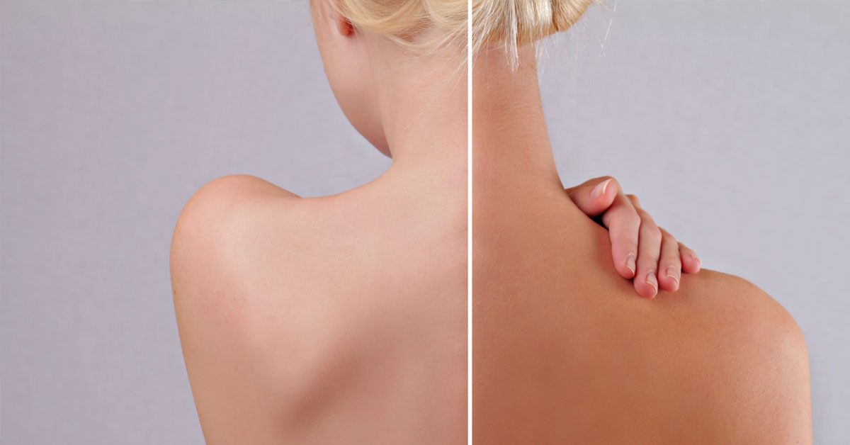 tan back