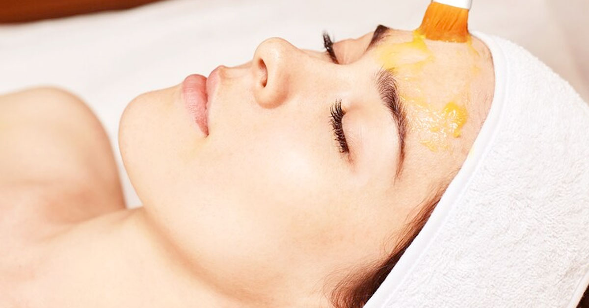 New age χημικά peeling: Ωραία και καθόλου απαγορευτική πρόταση για αναζωογόνηση του δέρματος κατά την περίοδο της ηλιοφάνειας.