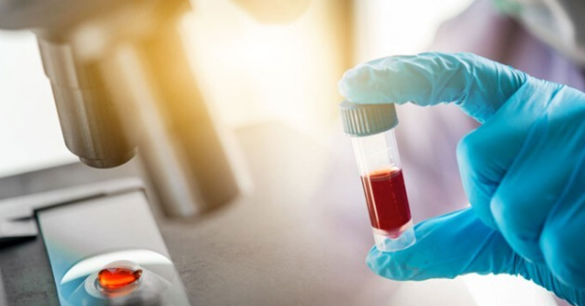 lab test