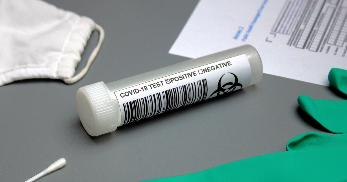covid19 diagnose