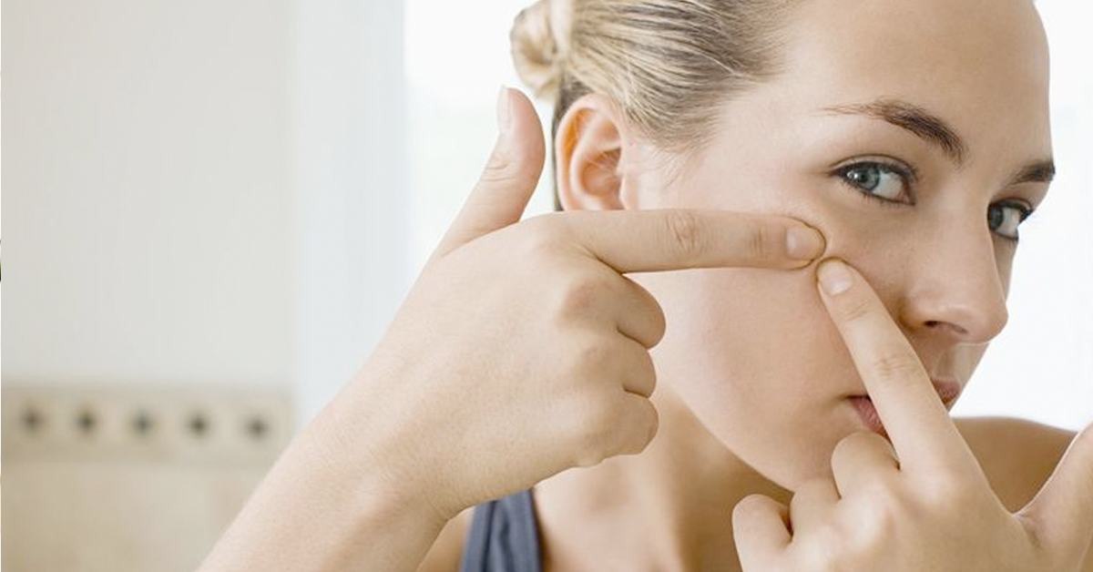 pimples cover