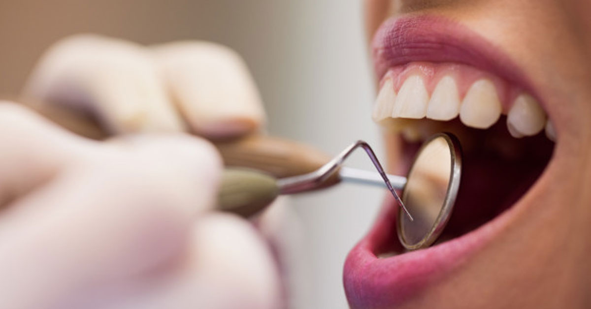 teeth 1