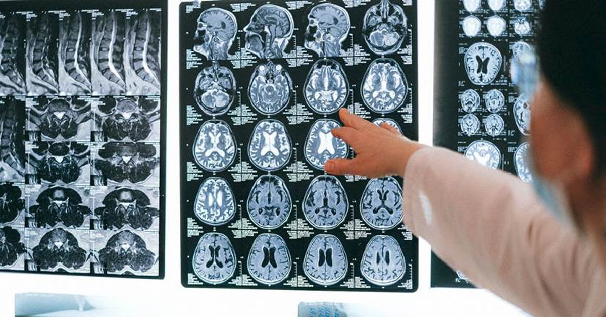 brain scan