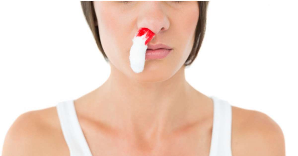 nose bleed