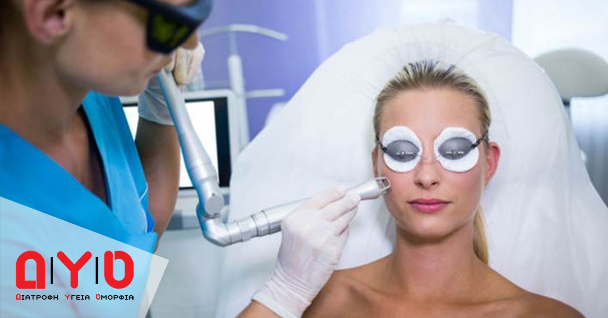 apotrixosi laser