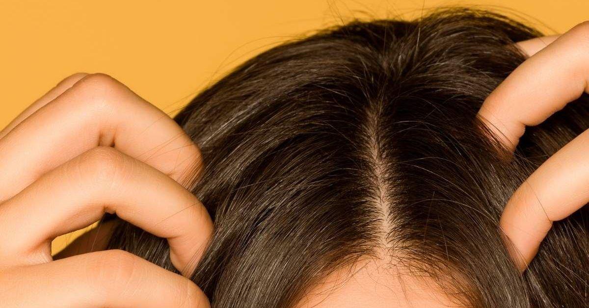 scalp