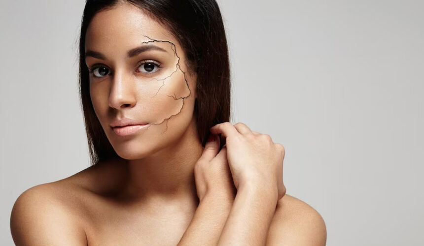 dry-skin-concept