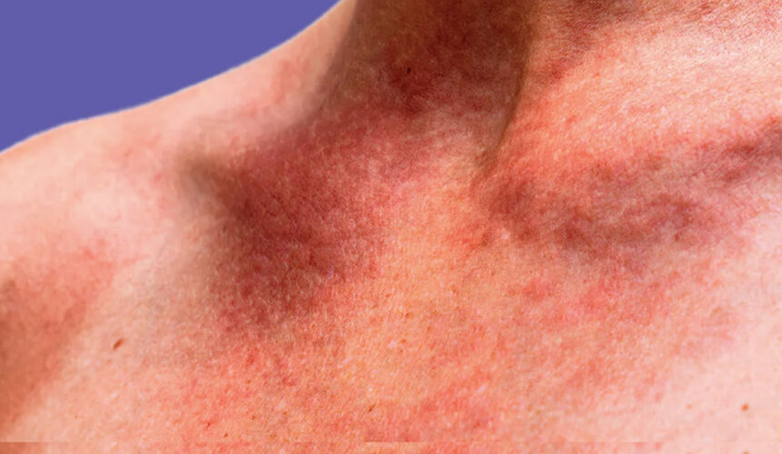 skin