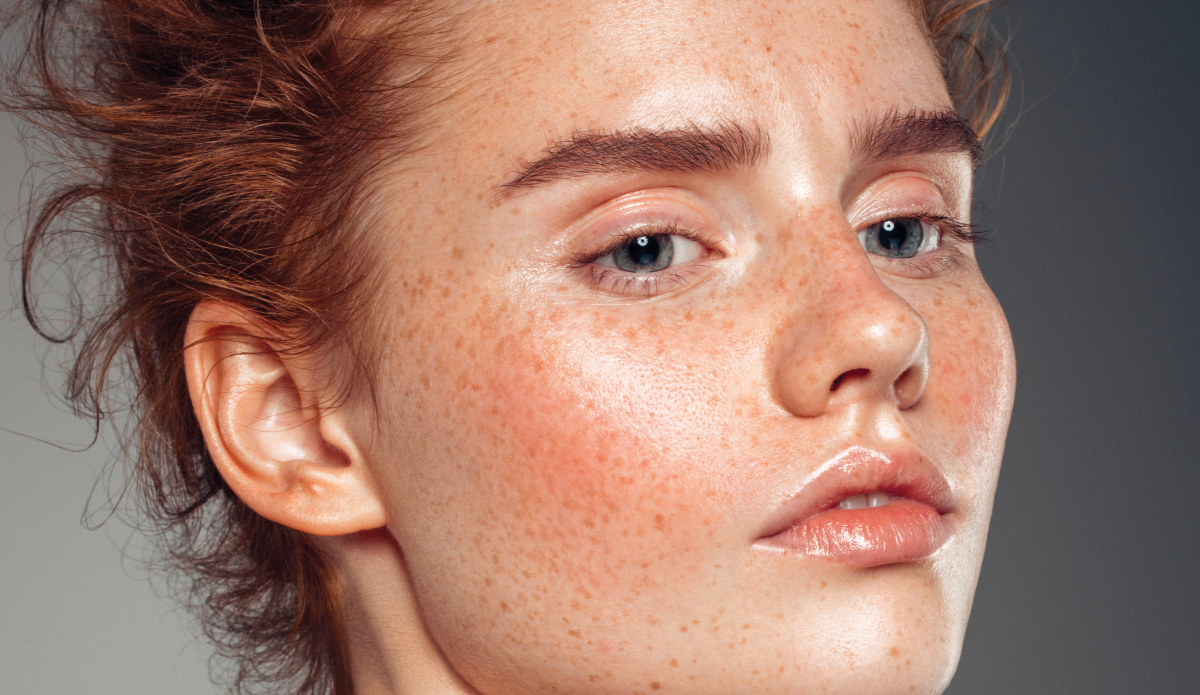 Δυσχρωμίες